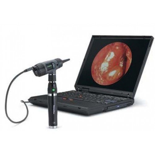 Otoscópio Digital Macroview Welch Allyn c/Cabo de Litium Otoscópio Digital Macroview Welch Allyn c/Cabo de Litium